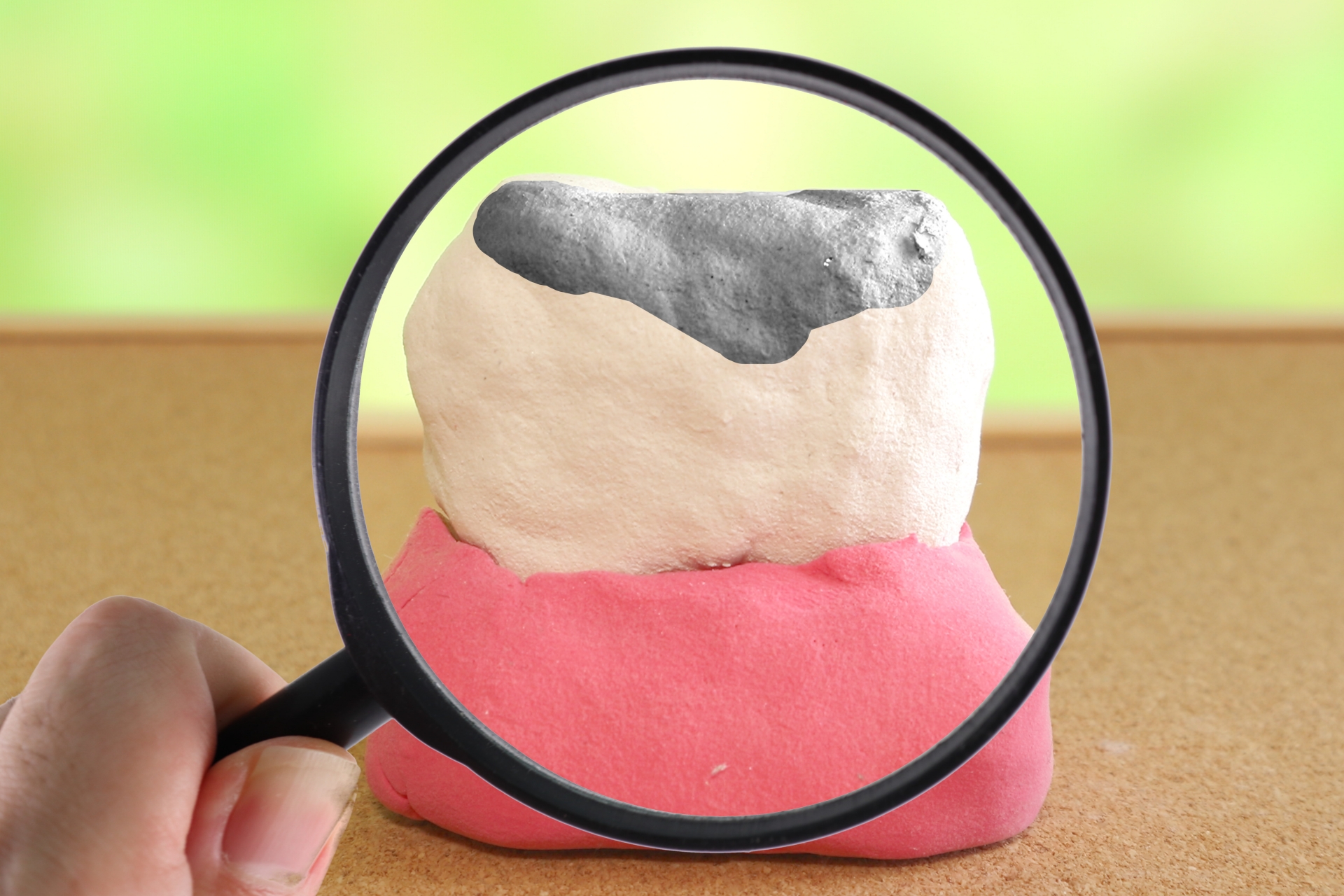 世界最小モーターで「虫歯」を攻略せよ！