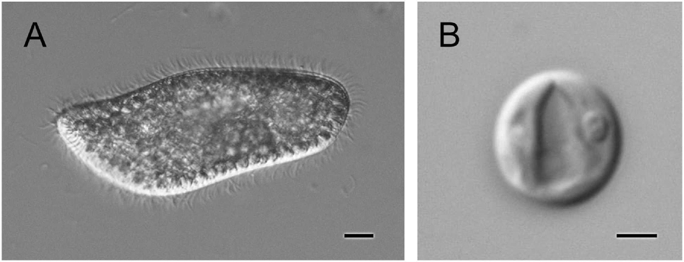ミドリゾウリムシ共生藻の細胞壁の厚さや化学組成は 単独培養時と共生時で変化することを明らかに 長浜バイオ大学