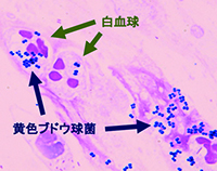 臨床微生物学研究室