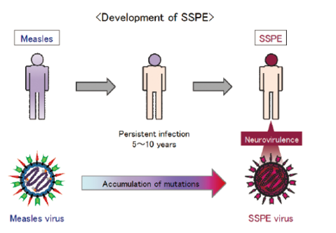 Pathogenicity of subacute sclerosing panencephalitis (SSPE) virus